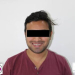 dental implants hospital in Nagpur