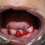 Dentist in ramdaspeth