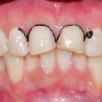 Dentist in ramdaspeth