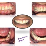 dental clinic in dharampeth